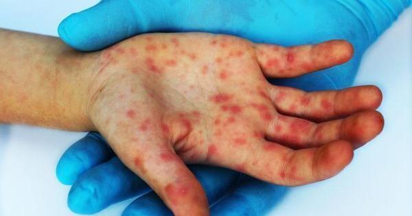 一分钟介绍微信链接炸金花免费挂-链接找谁买-