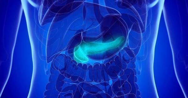 胰腺囊肿的新检测可能提高癌症检测