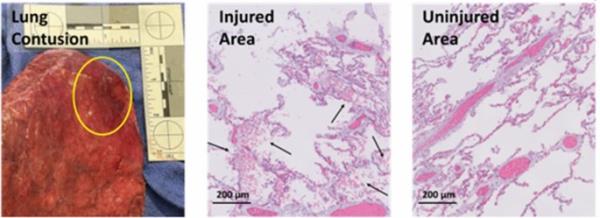 最新教你“哥哥跑得快开挂神器”详细开挂玩法